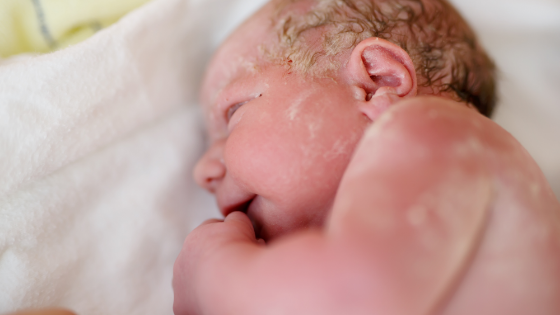 Newborn Baby Laying Down With Vernix